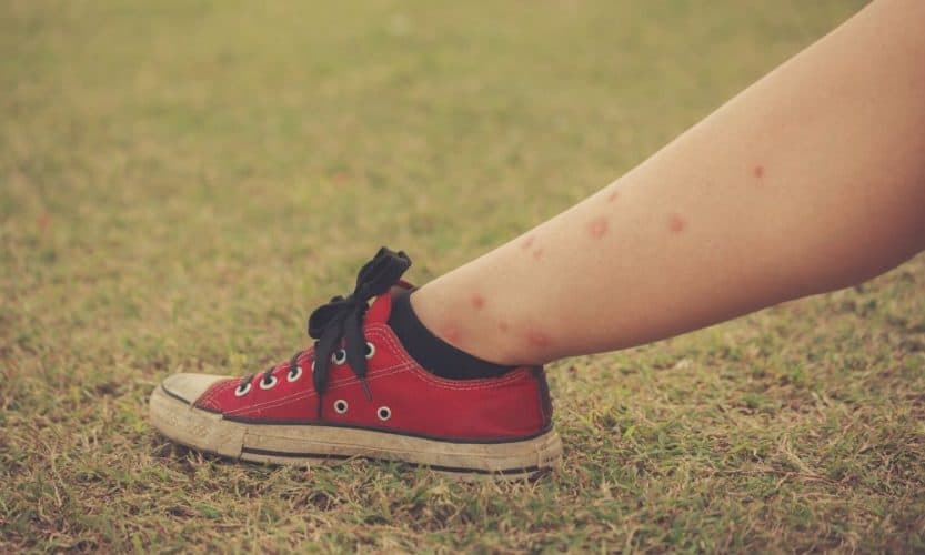 How to Get Rid of Biting Flies at the Beach Seaside